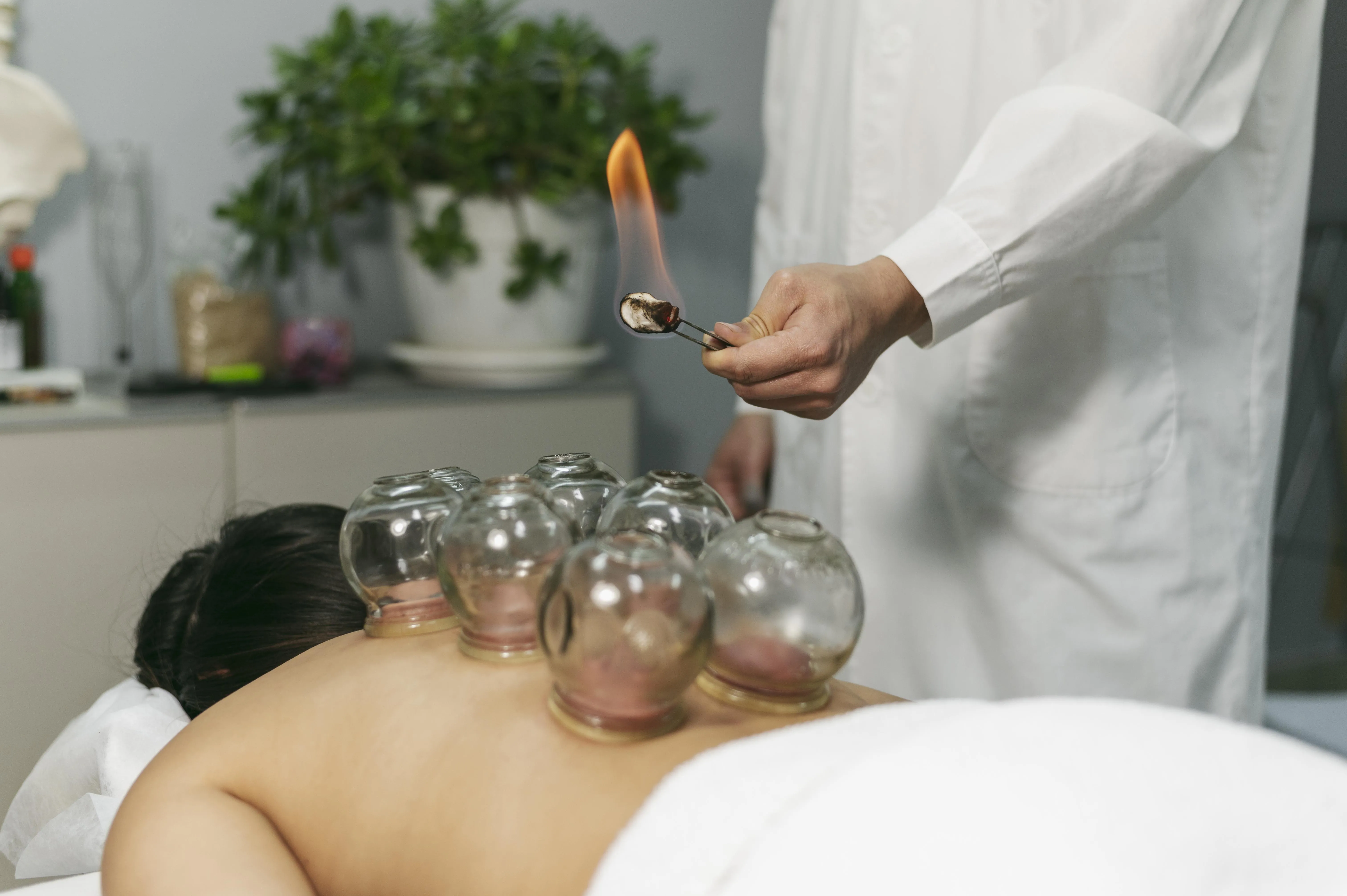 Cupping